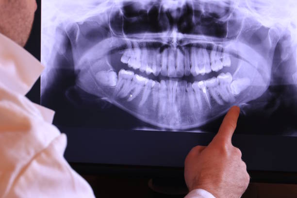 Best Emergency Treatment for Dental Infections or Abscesses in Blawnox, PA